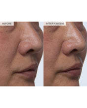 Load image into Gallery viewer, Watermelon Glow PHA+BHA Pore-Tight Toner
